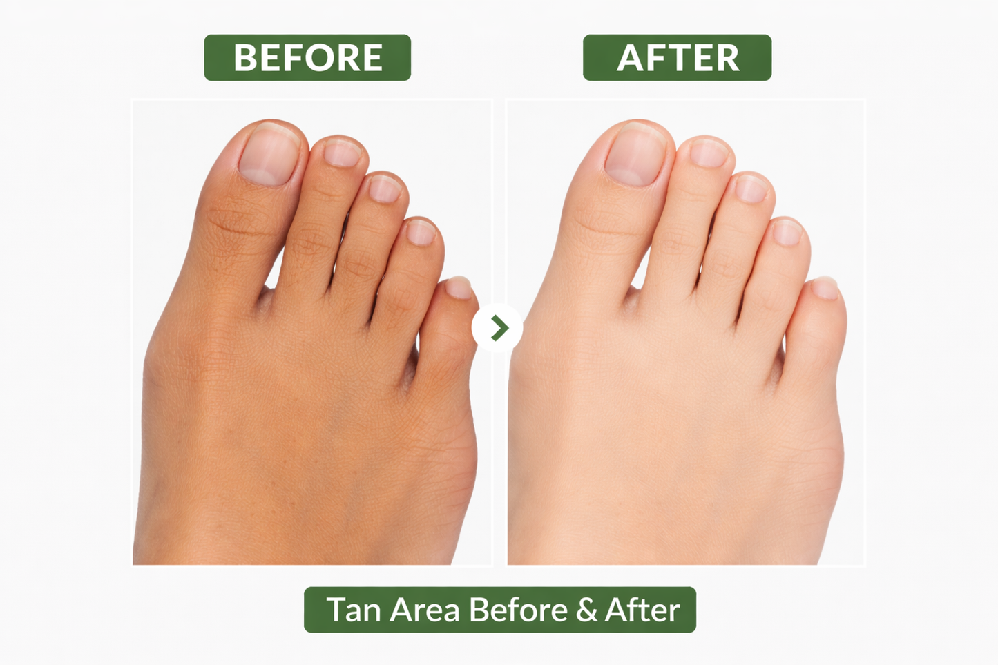 Gloweza De Tan Face Pack for Tan Removal - 100g